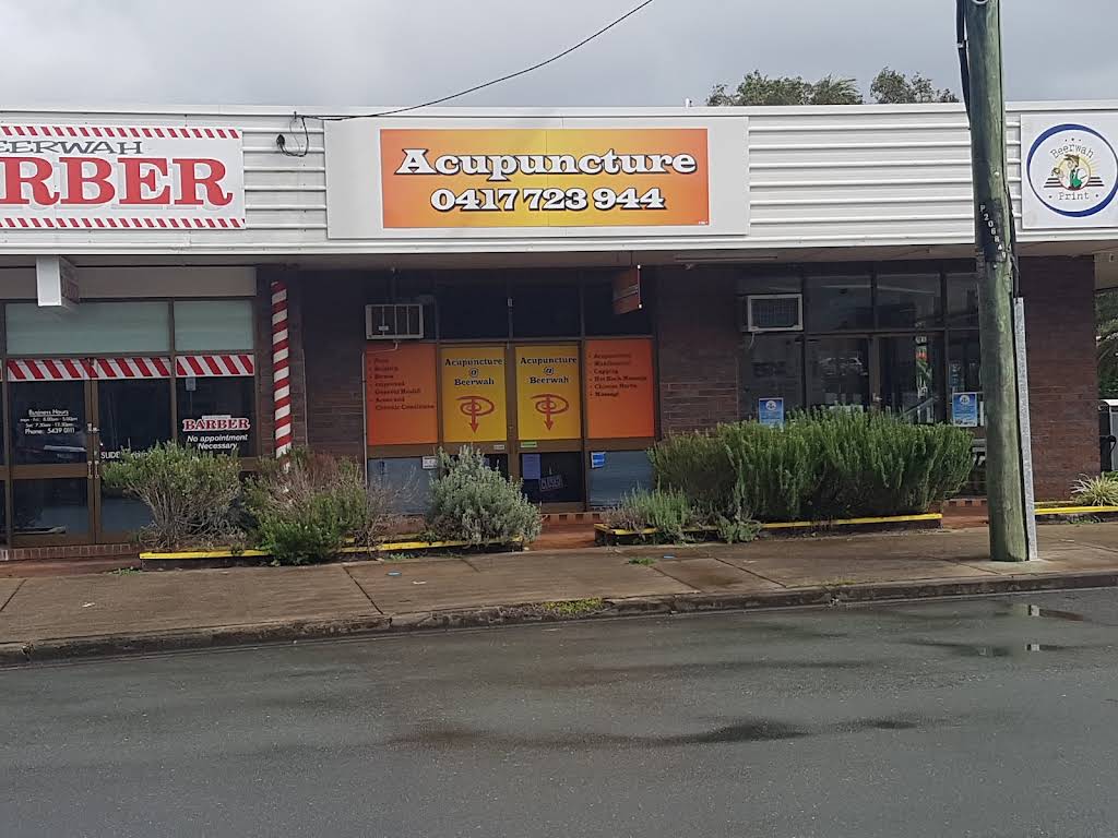 Acupuncture @, Beerwah, QLD